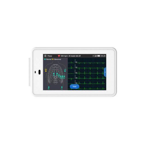 Viatom ECG-500 6-12 elvezetéses zseb EKG készülék